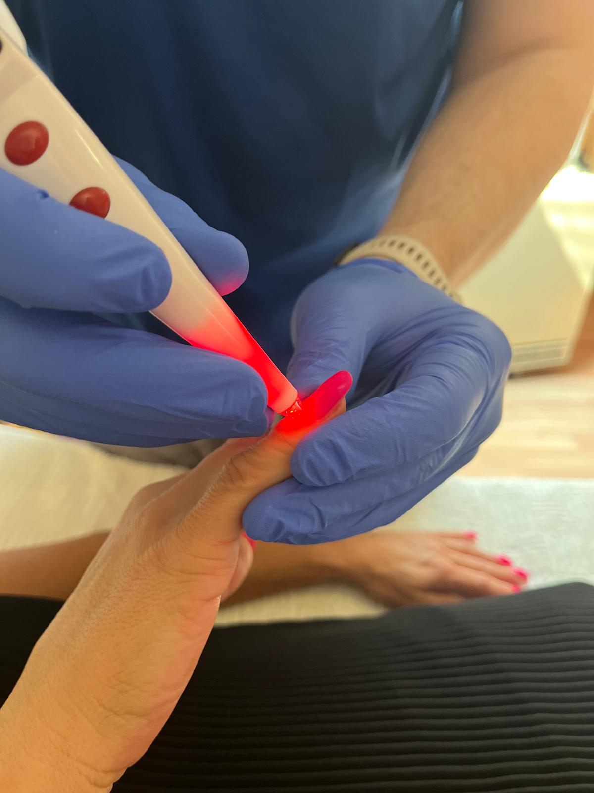 akupunktura za glavobolju